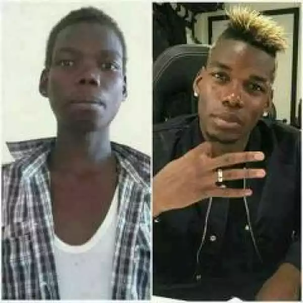 These Before & After Photos Of Pogba Will Show You That No Condition Is Permanent